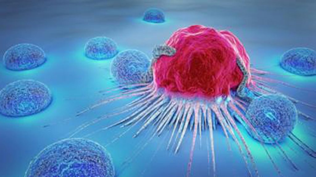 COVID-19 and cancer: Nigeria’s unique quadruple jeopardy